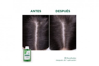Shampoo Klorane Pelo Graso Ortiga 200 Ml