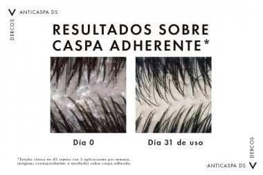 Shampoo Dercos Anticaspa 200 Ml