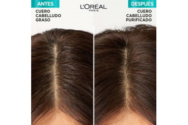 Acondicionador Elvive Hialuro Pure 370 Ml