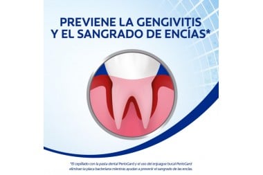 Enjuague Bucal Colgate Periogard Encías Saludables 2 L