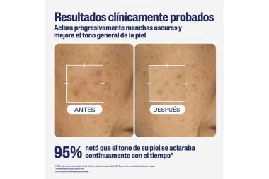 Serum Antimanchas Cetaphil Hearthy Radiance 30 Ml