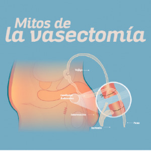 Mitos de la vasectomía